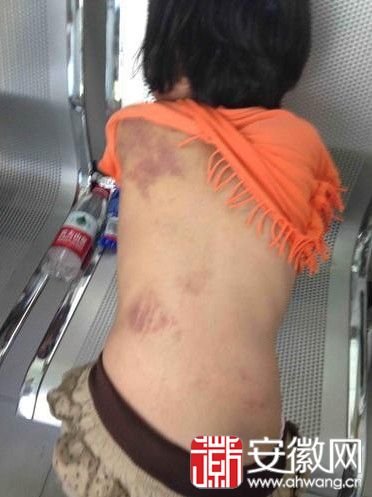 <a href='display.asp?id=11916'  target='_blank'>芜湖</a>女孩被打