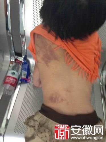芜湖女孩被父母虐待