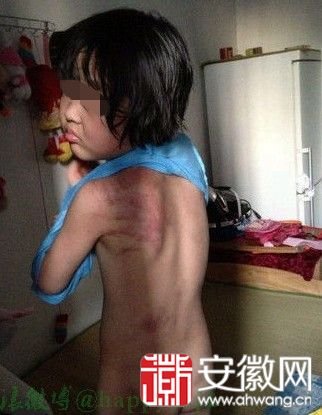 芜湖小女孩被父母打
