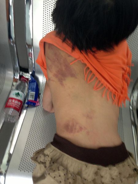 <a href='display.asp?id=11916' target='_blank'>芜湖</a>女童被父母毒打