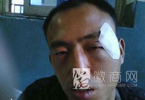 凤阳县辅警围殴两男子 被打伤者