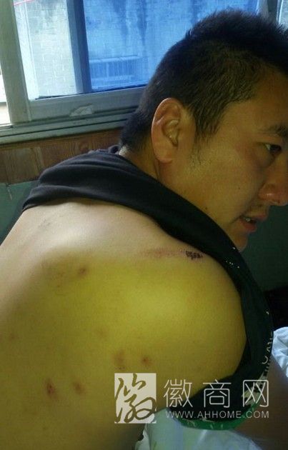 凤阳县辅警围殴两男子 被打伤者