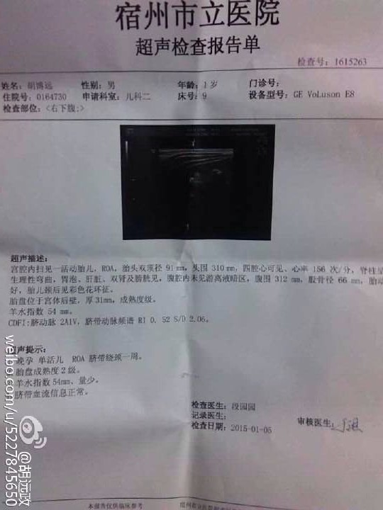 1岁男童怀孕报告