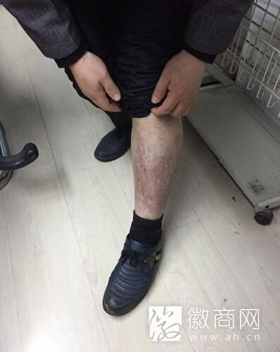 马钢合肥公司员工